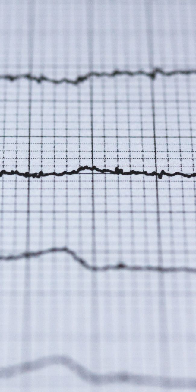 ECG av